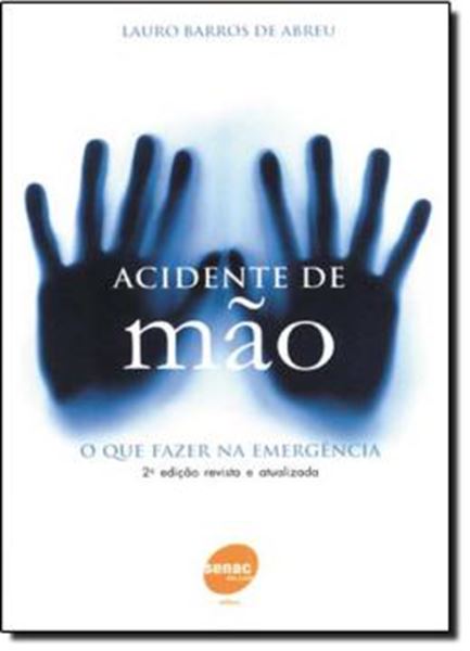 Picture of ACIDENTE DE MAO - O QUE FAZER NA EMERGENCIA