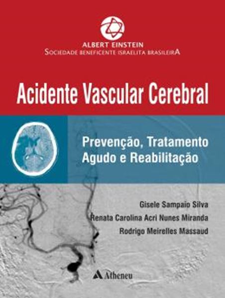 Picture of ACIDENTE VASCULAR CEREBRAL