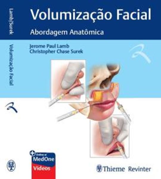 Picture of VOLUMIZACAO FACIAL