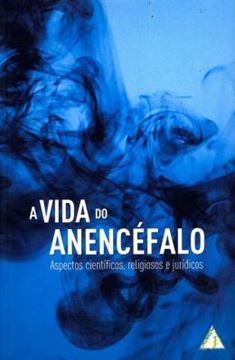 Imagem de A VIDA DO ANENCEFALO