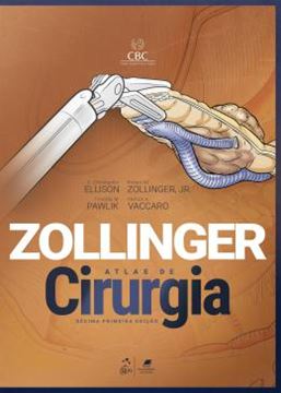 Imagem de ZOLLINGER - ATLAS DE CIRURGIA - 11ª ED
